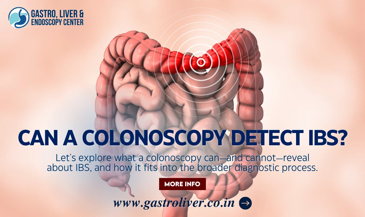 Can a Colonoscopy Detect IBS?