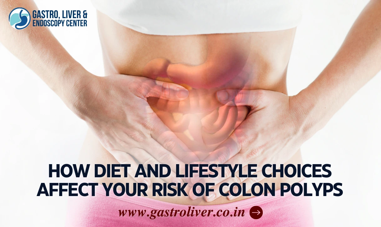 How Diet and Lifestyle Choices Affect Your Risk of Colon Polyps