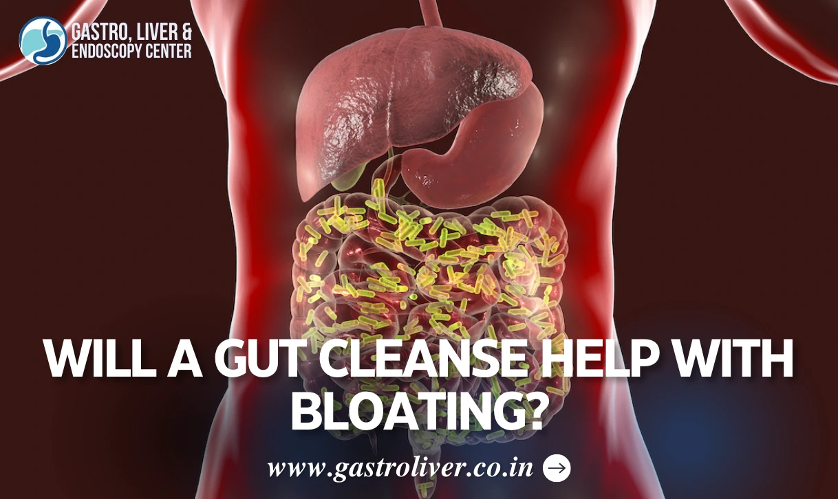 Will a Gut Cleanse Help with Bloating?