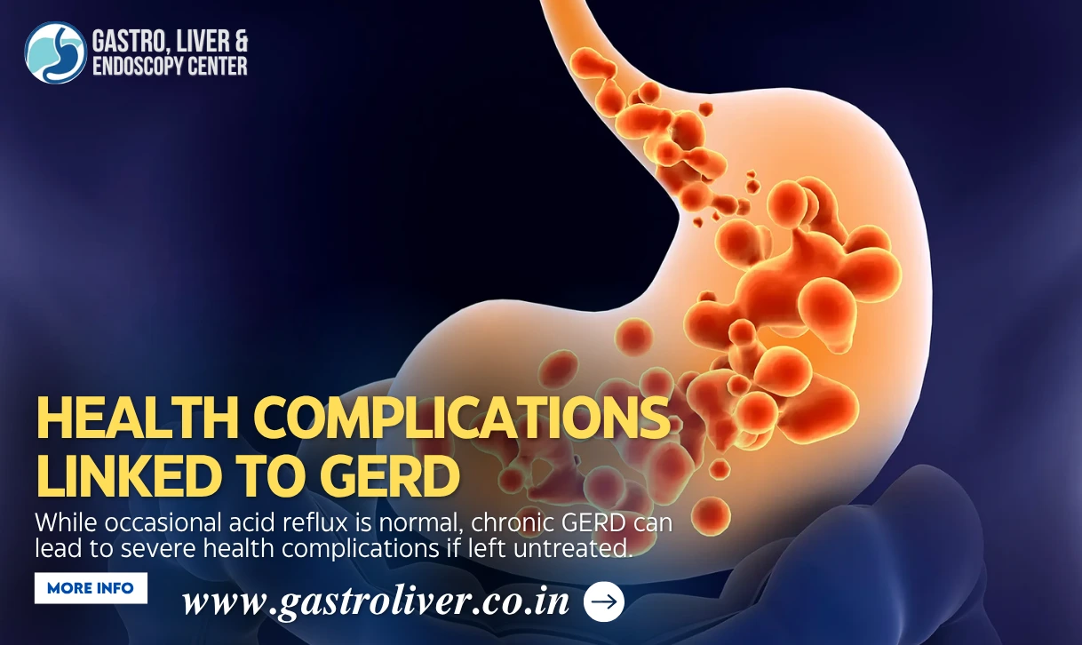 Health Complications Linked to GERD