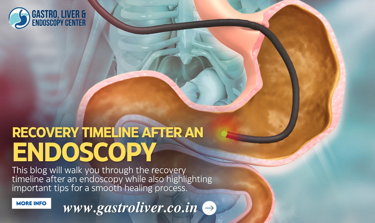 Recovery Timeline after an Endoscopy