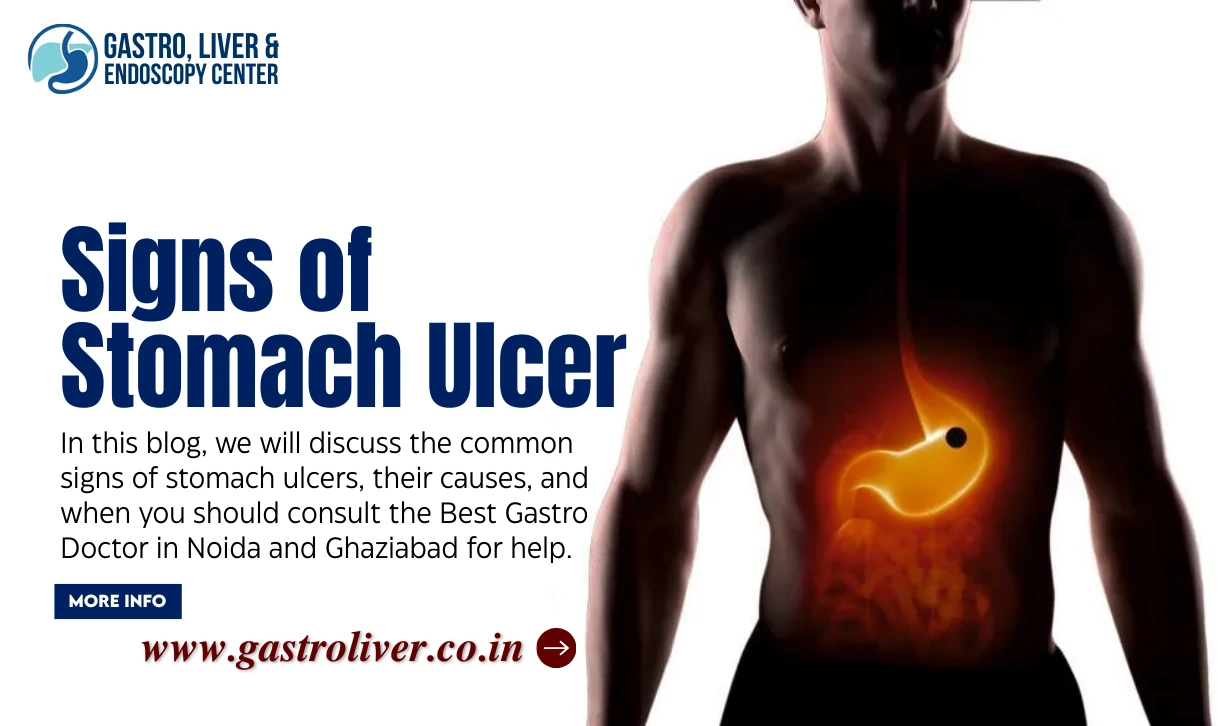 Signs of Stomach Ulcer