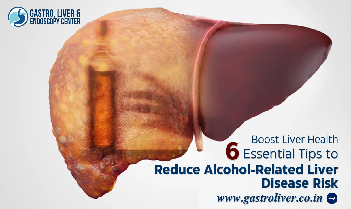 Boost Liver Health: 6 Essential Tips to Reduce Alcohol-Related Liver Disease Risk