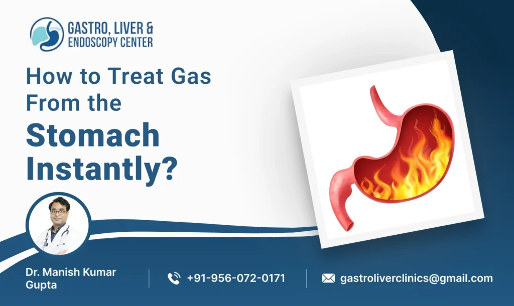 How to Remove Gas From the Stomach Instantly?