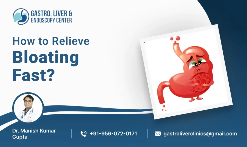 How to Relieve Bloating Fast