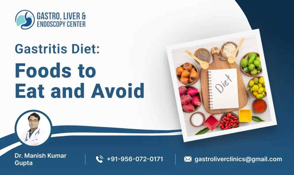 Gastritis Diet: Foods to Eat and Avoid