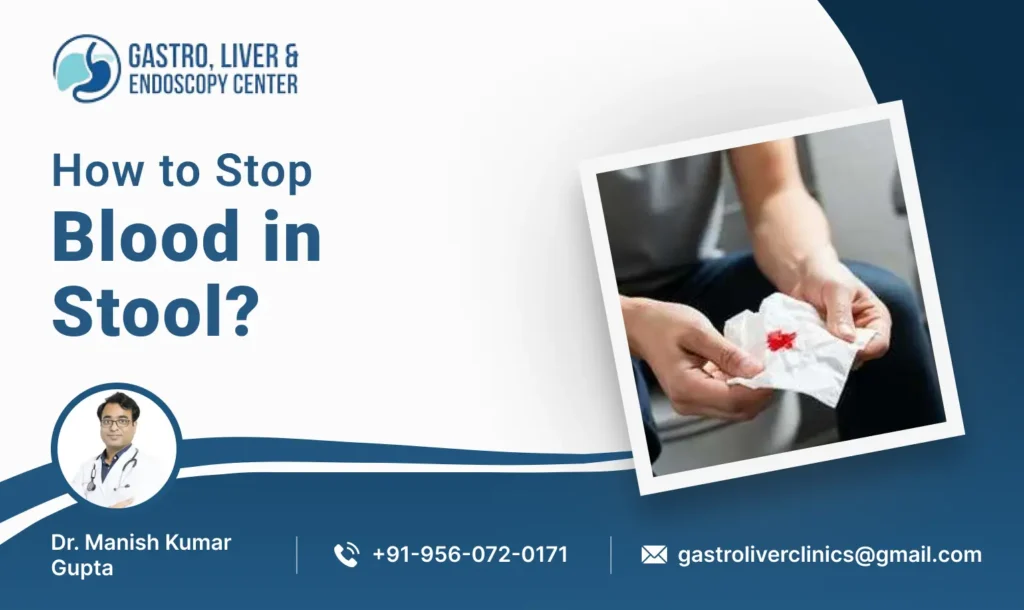 How to Stop Blood in Stool?