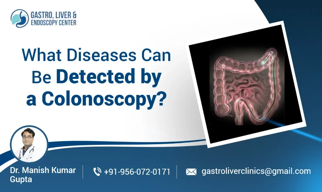 What Diseases Can Be Detected by a Colonoscopy?