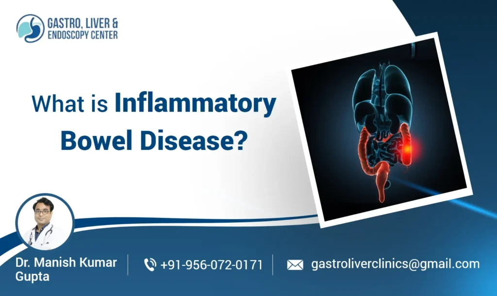 What Is Inflammatory Bowel Disease?