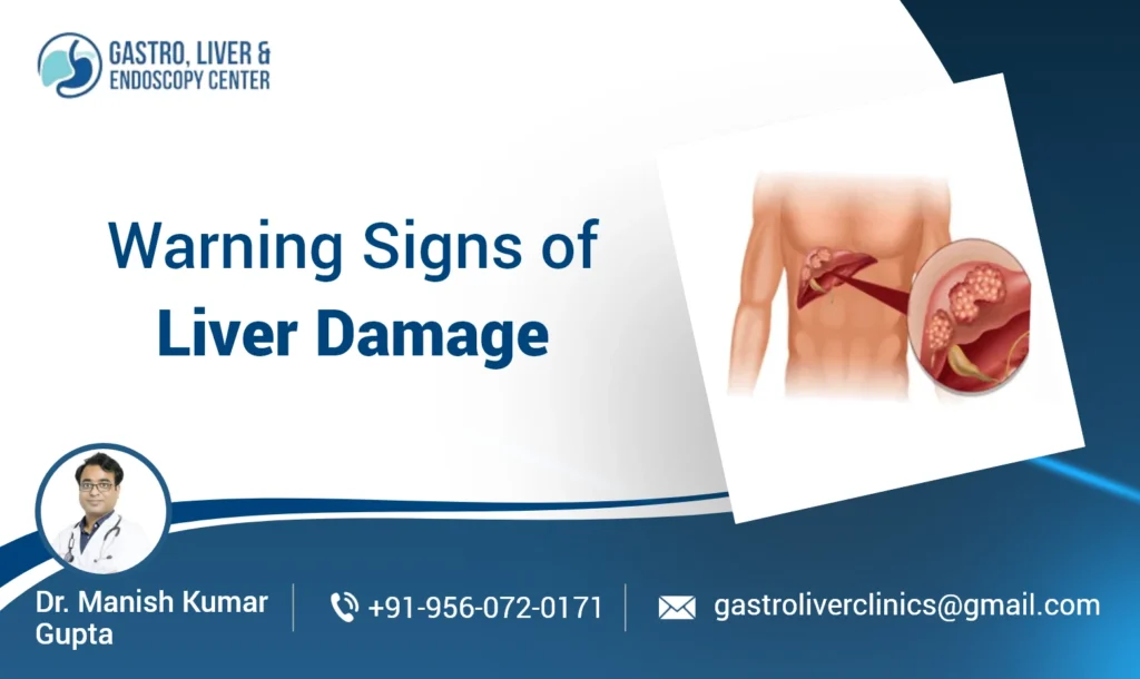 Warning Signs of Liver Damage You Must Not Ignore
