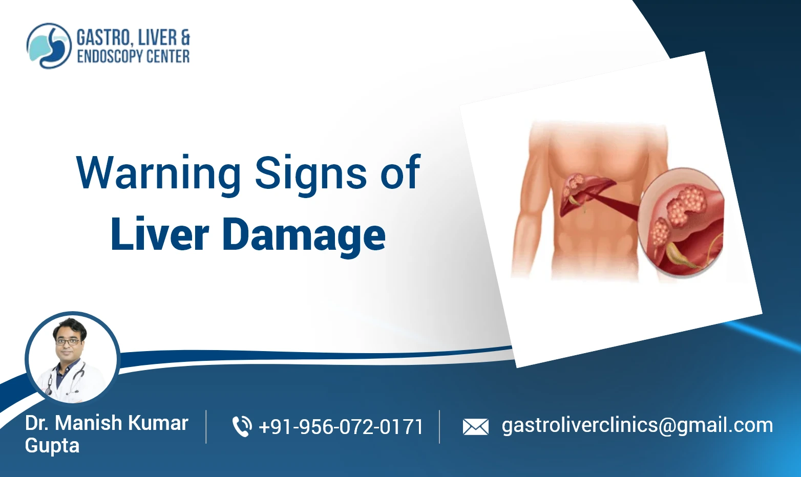 Warning Signs of Liver Damage You Must Not Ignore