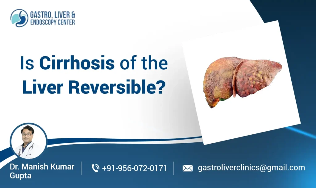 Is Cirrhosis of the Liver Reversible​?
