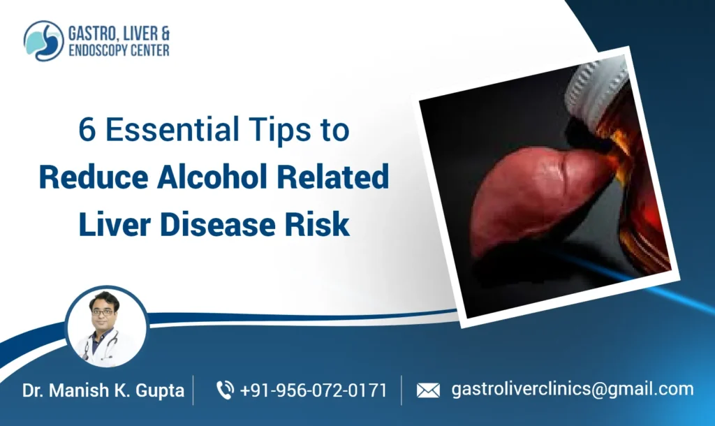 6 Essential Tips to Reduce Alcohol Related Liver Disease Risk