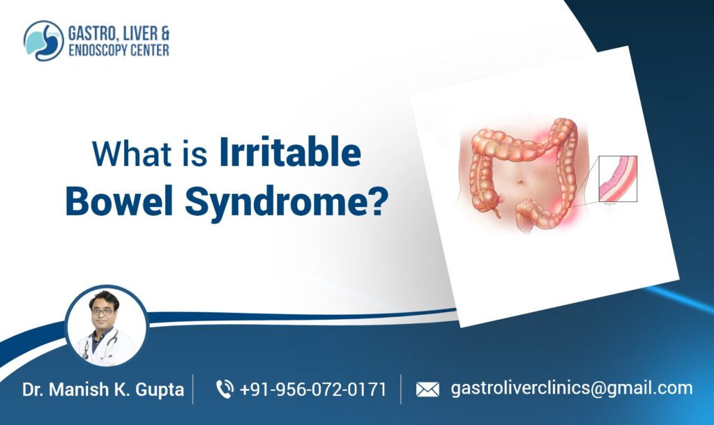 What is Irritable Bowel Syndrome​? Causes, Symptoms and Treatment