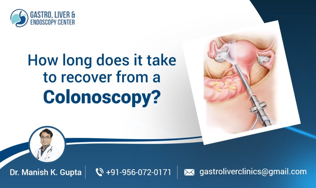 How long does it take to recover from a Colonoscopy?