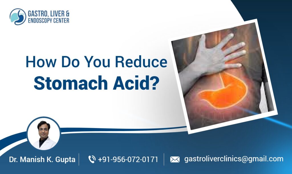 How Do You Reduce Stomach Acid?