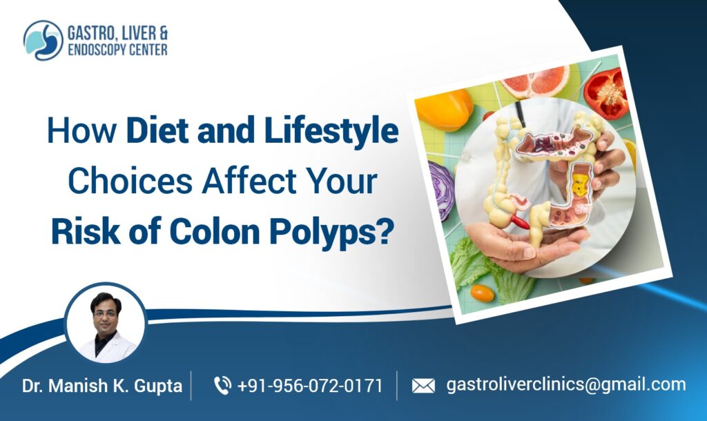How Diet and Lifestyle Choices Affect Your Risk of Colon Polyps?
