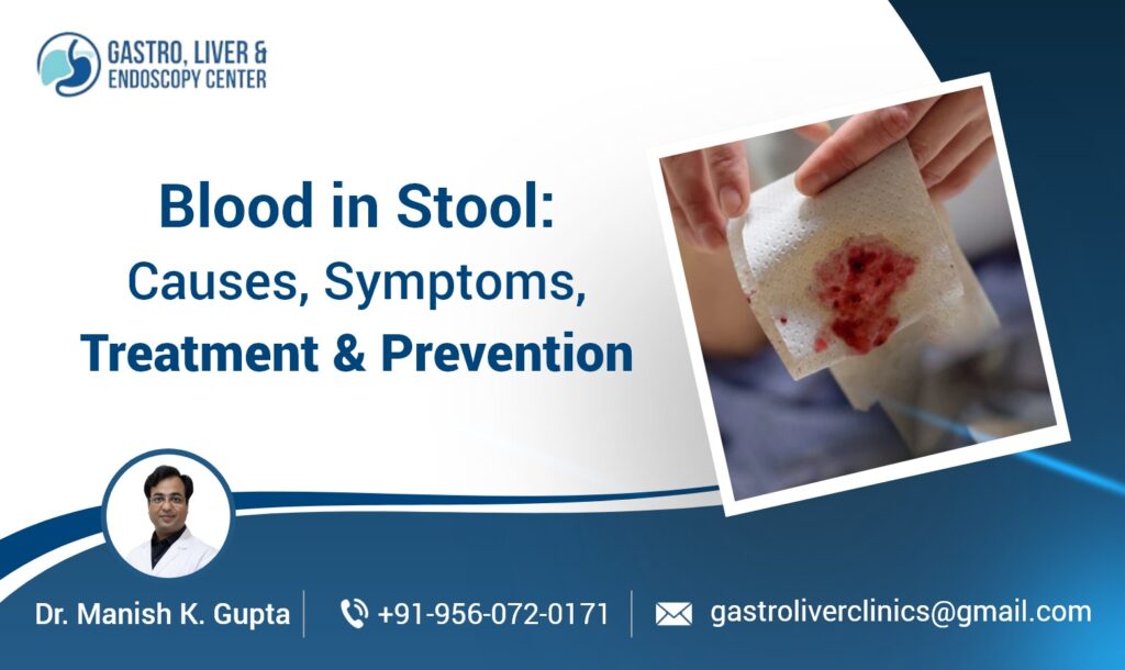 Blood in Stool: Causes, Symptoms, Treatment & Prevention