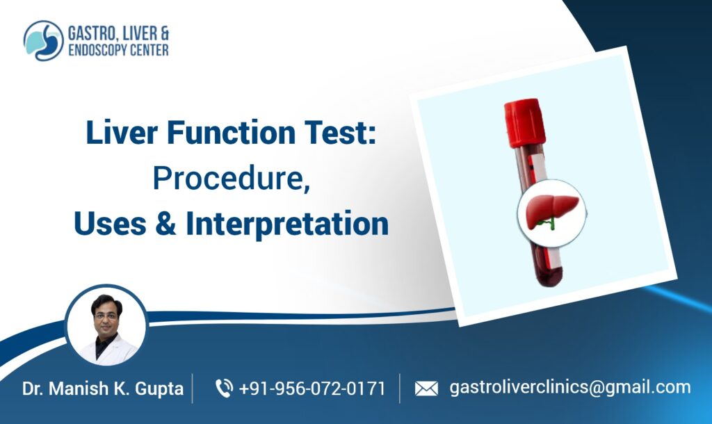 Liver Function Test: Procedure, Uses & Interpretation