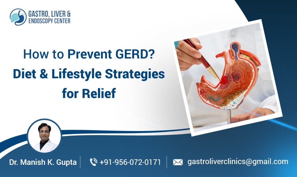 How to Prevent GERD? Diet & Lifestyle Strategies for Relief