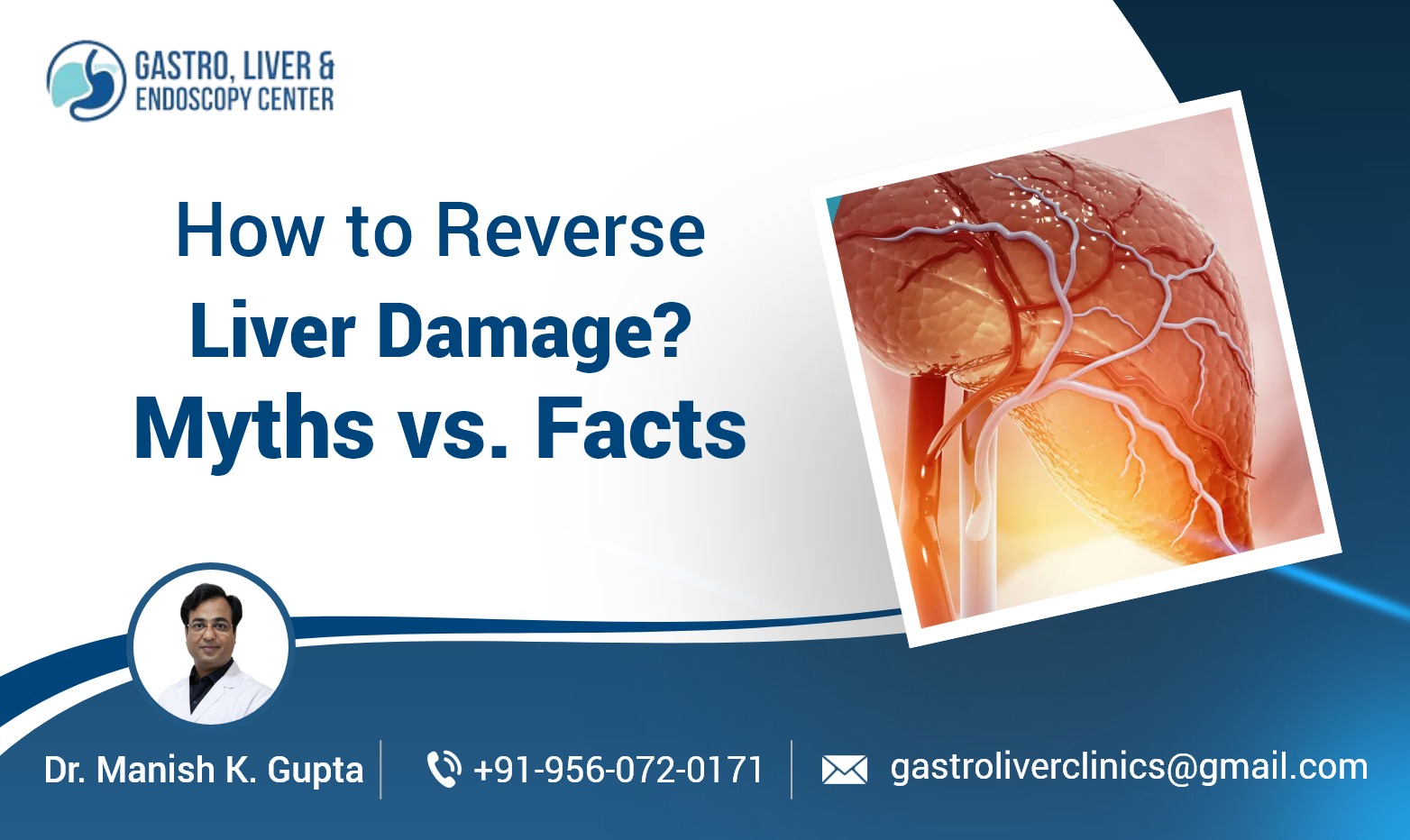 How to Reverse Liver Damage? Myths vs. Facts​