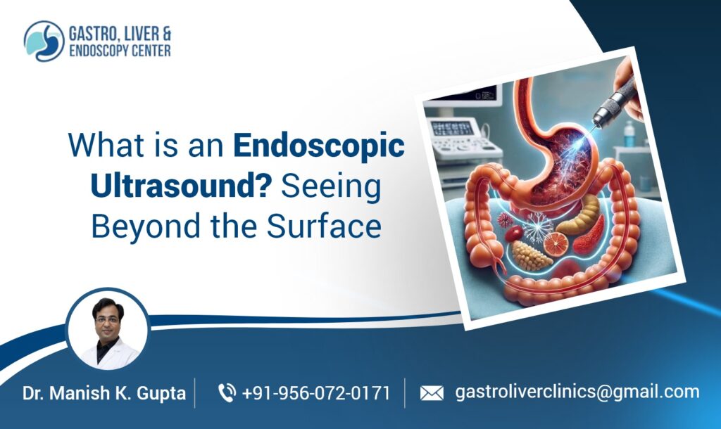 What is an Endoscopic Ultrasound? Seeing Beyond the Surface