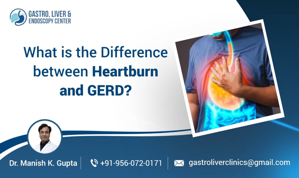 What is the Difference between Heartburn and GERD?