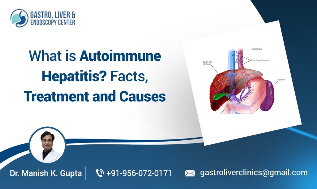 What is Autoimmune Hepatitis​? Facts, Treatment and Causes