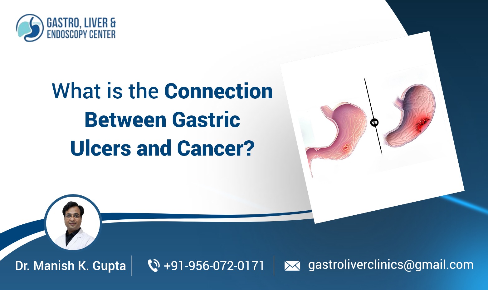 What is the Connection Between Gastric Ulcers and Cancer?