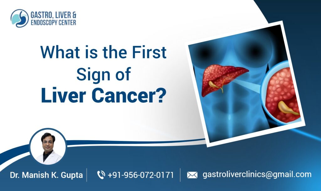 What is the First Sign of Liver Cancer?