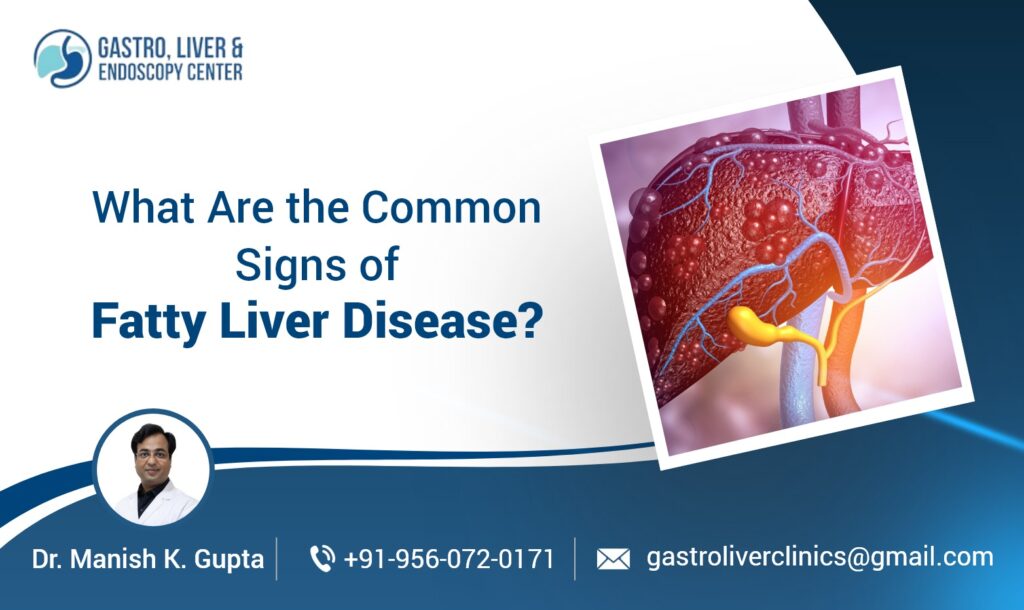 What Are the Common Signs of Fatty Liver Disease?